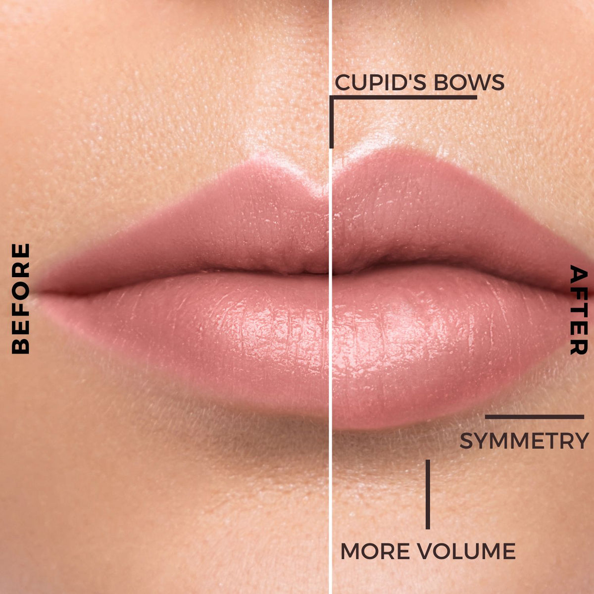 LIP BOOSTER – More Lip Volume